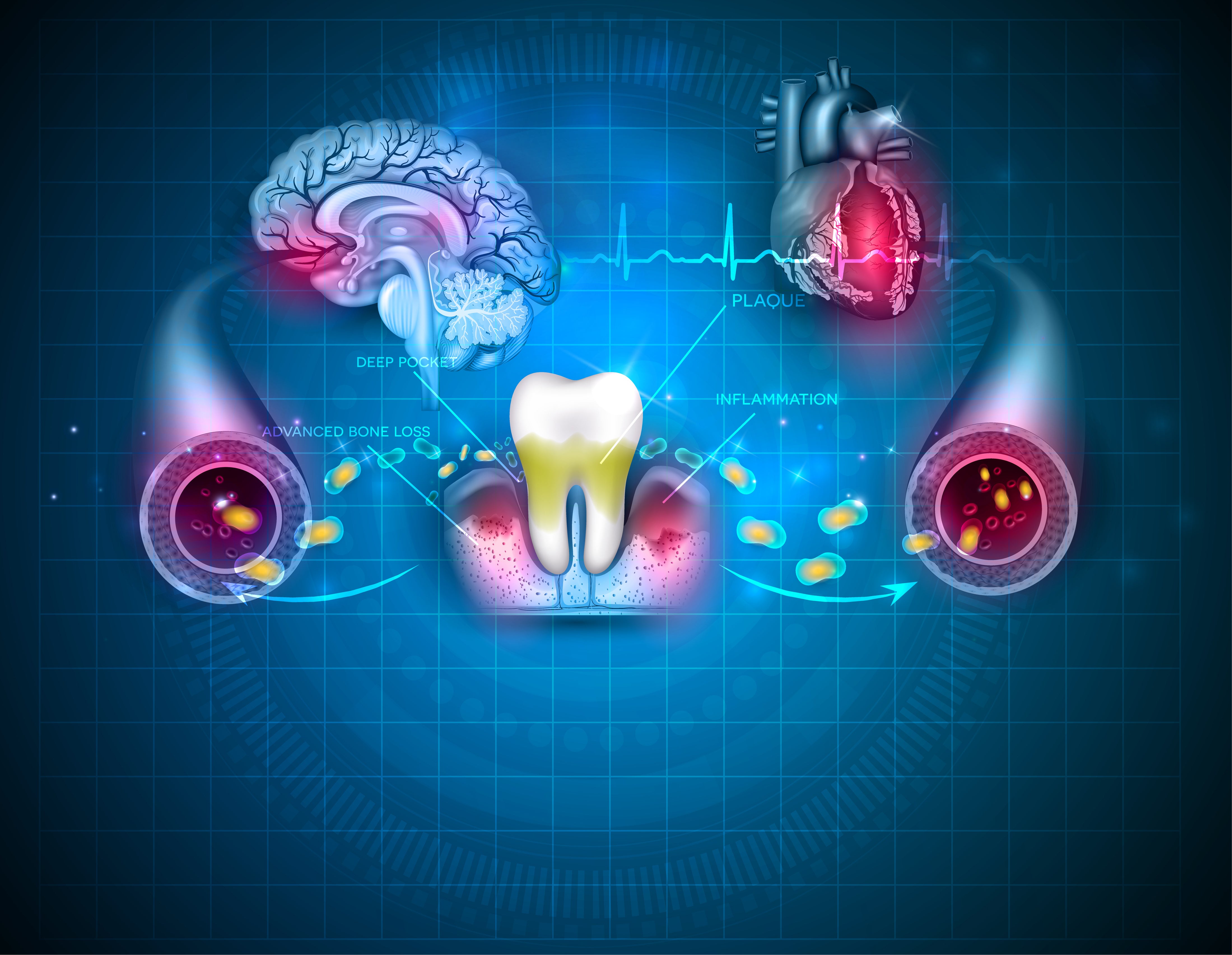 The mouth is a gateway to infection in the body